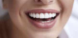 ağrısız diş beyazlatma