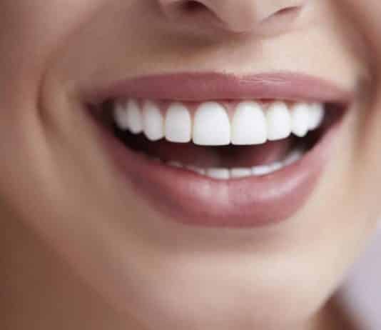 ağrısız diş beyazlatma
