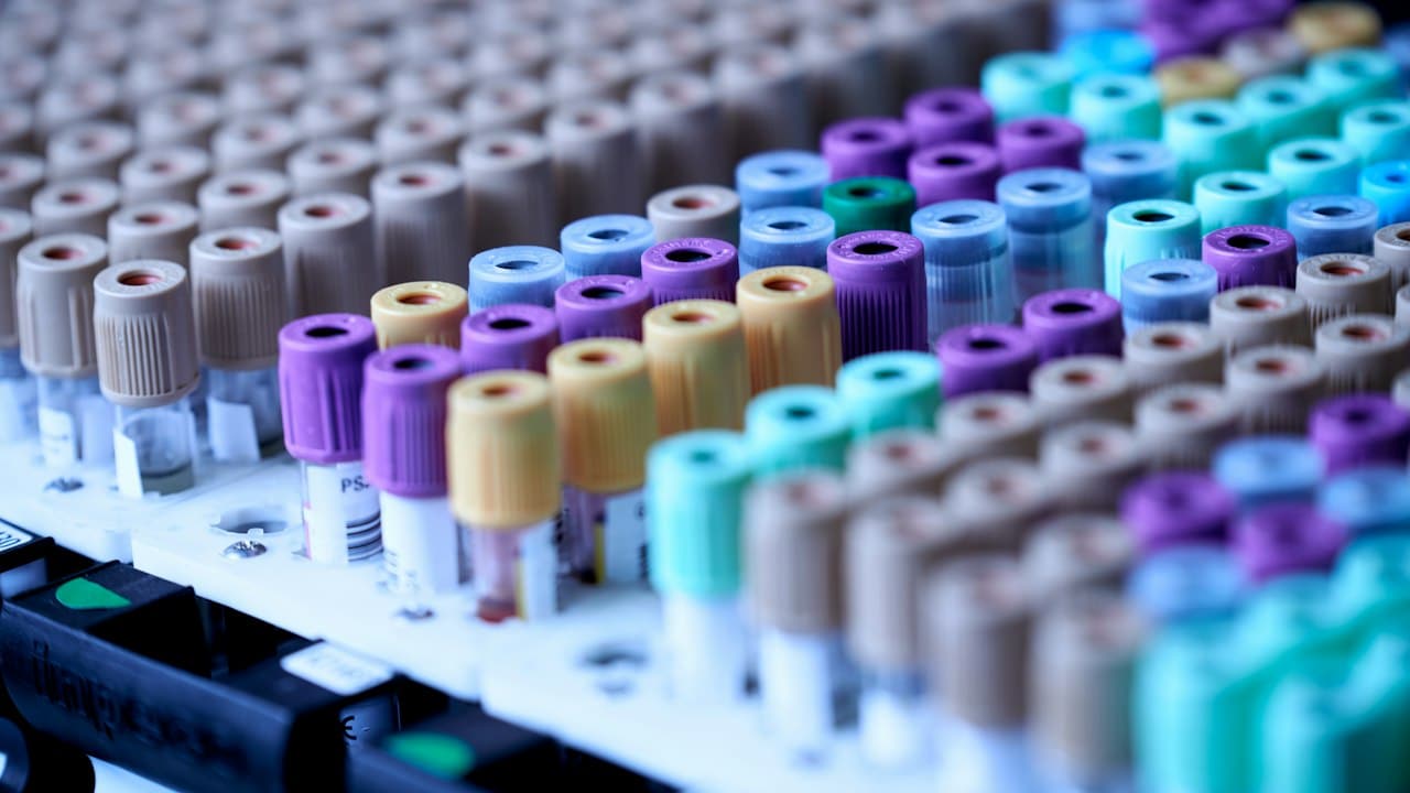 Laboratuvar rafında renkli kapaklı kan tüpleri