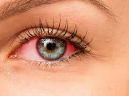 Üveit nedir? Göz sağlığınızı erken tanı ile koruyun!