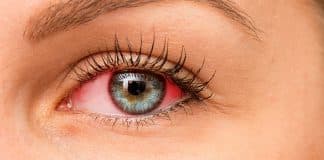 Üveit nedir? Göz sağlığınızı erken tanı ile koruyun!