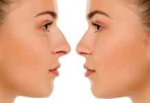 Kalın derili olan kişiler de güzel bir burun sahibi olabilir güzel bir burun