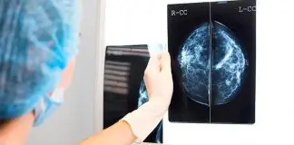 Meme kanserinin verdiği önemli sinyaller neler?