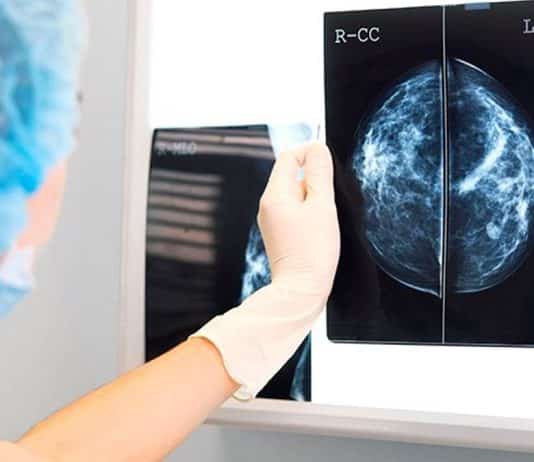 Meme kanserinin verdiği önemli sinyaller neler?