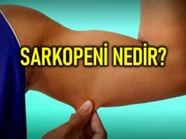 sarkopeni nedir
