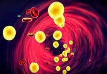 Kolesterol nasıl düşürülür? Yüksek kolesterol belirtileri neler? Kolesterol nasıl düşürülür? Yüksek kolesterol belirtileri neler?