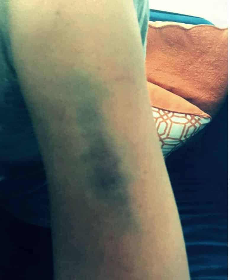 Sıla: Ahmet Kural beni yerlerde sürükledi, kafamı duvarlara vurdu