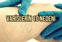 Varise yol açan nedenler neler? Bu 10 faktöre dikkat! Varise yol açan nedenler neler? Bu 10 faktöre dikkat!