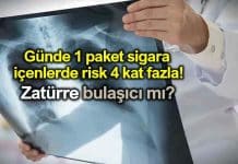 Zatürre (pnömoni) nedir? Nasıl bulaşır? Belirtileri neler? Zatürre (pnömoni) nedir? Nasıl bulaşır? Belirtileri neler?