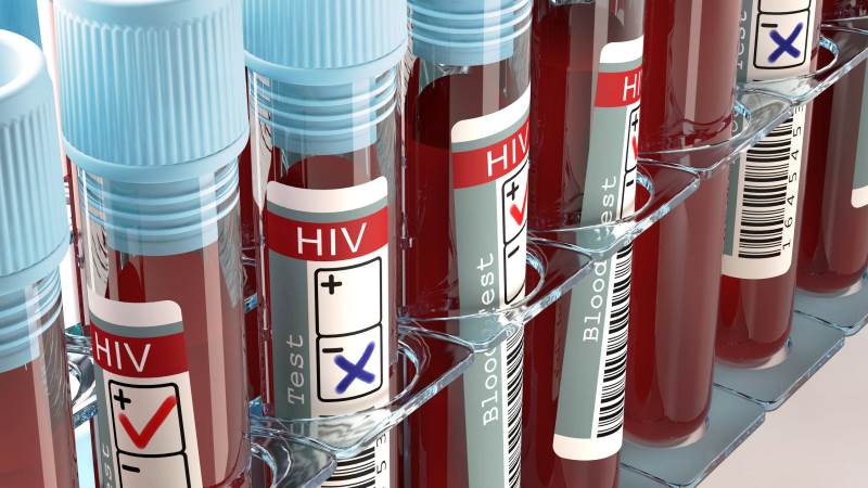 hiv testi HIV virüsü taşıyanlar çocuk sahibi olabilir mi?