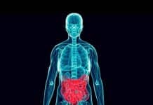 Crohn ve kolit vücuttaki her organı etkiliyor! Crohn ve kolit vücuttaki her organı etkiliyor!