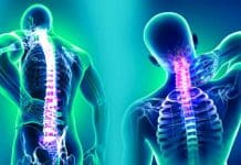 Fibromiyalji nedir? Belirtileri neler? Fibromiyalji nedir? Belirtileri neler?