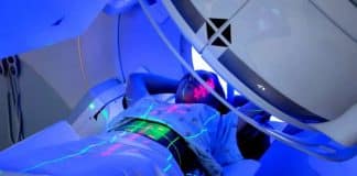 Radyoterapi nedir? 8 soruda ışın tedavisi nasıl yapılır? kanser türleri