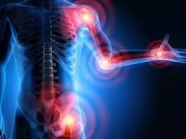 Ağrı 3 aydan fazla sürüyorsa hastalık belirtisi olabilir!