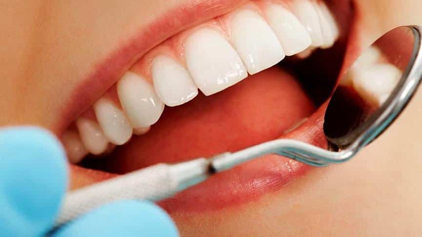 Ortodonti diş teli tedavisi hakkında doğru bilinen yanlışlar