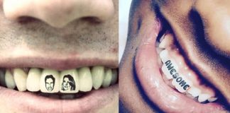 Diş dövmesi: Dişte yeni trend Tattoooth nasıl yapılır?