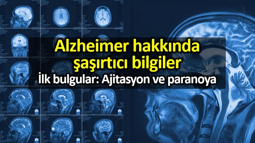 Sakin bir hayat, Alzheimer hastalığı riskini artırıyor!