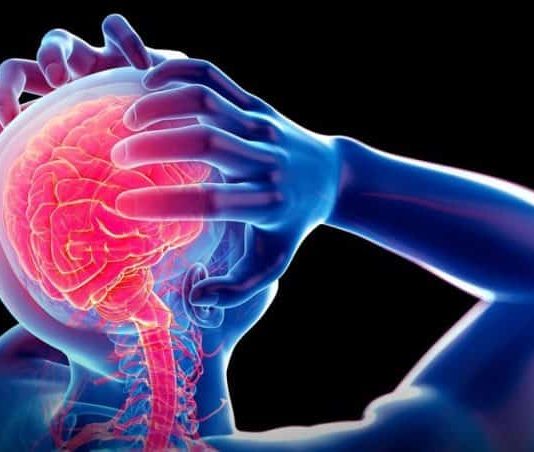 Beyin kanaması belirtileri neler? Yüksek tansiyona dikkat!