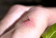 Sivrisinek tehlikesi: Kırmızı ve koyu renk sinekleri çekiyor! Sivrisinek tehlikesi: Kırmızı ve koyu renk sinekleri çekiyor!