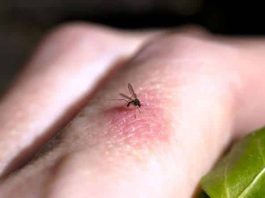 Sivrisinek tehlikesi: Kırmızı ve koyu renk sinekleri çekiyor!