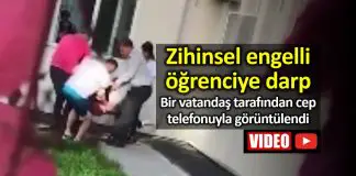 Kayseri’de zihinsel engelli öğrenciye darp iddiası! Kayseri de bir zihinsel engelli öğrenciye darp iddiası