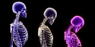 Osteoporoz nedir? Kemik erimesinden korunmak için 6 öneri