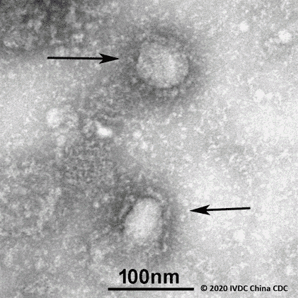 Şekil. Virüsün elektron mikroskopunda görüntüsü.