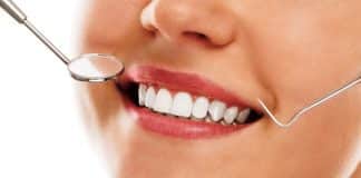 Dental lazer nedir? Diş esteti ve diş eti tedavisinde etkili uygulama