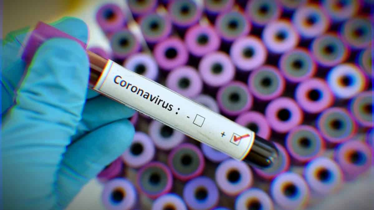 Çin den açıklama: Koronavirüs aşısını bulduk, son testleri yapıyoruz