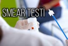 Smear testi nedir? Rahim ağzı kanseri belirtileri neler? Smear testi nedir? Rahim ağzı kanseri belirtileri neler?