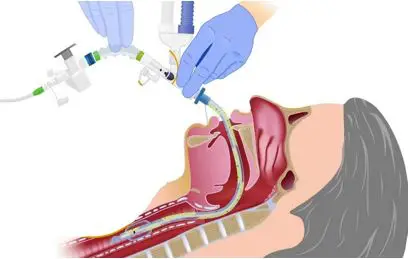 corona virusu sozluk nedir ne anlama gelir 1 bolum