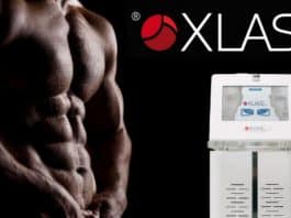 xlase lazer erkek epilasyon