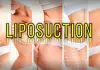 En güncel 10 Liposuction Doktoru (2026 Güncellendi) Liposuction etkileri