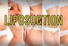 En güncel 10 Liposuction Doktoru (2026 Güncellendi) Liposuction etkileri