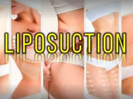 Liposuction etkileri