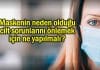 maske cilt sorunu