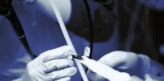 Bronkoskopi nedir? Akciğer hastalıklarında tanı ve tedavide kullanılıyor Bronkoskopi nedir?