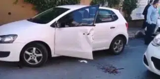 Beyin cerrahı, kopan parmaklarıyla hastaneye koştu! Beyin cerrahı