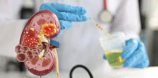 Böbreklerin sağlıklı olup olmadığı nasıl anlaşılır? Böbreklerin sağlıklı
