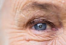 Katarakt hakkında 10 soru: Bulanık görme ve ışık hassasiyeti varsa! Katarakt bulanık görme