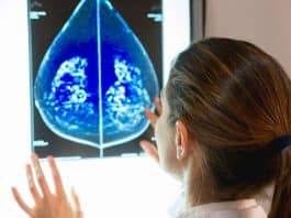 Memede görülen kitle