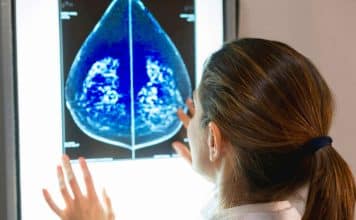 Memede görülen kitle