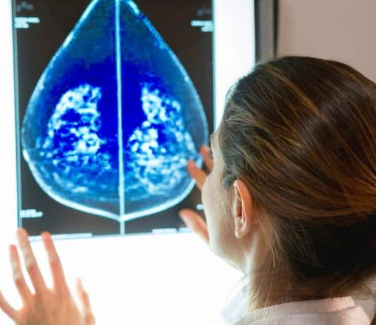 Memede görülen kitle