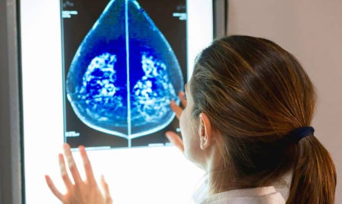 Kan en knöl i bröstet vara ett tecken på cancer?