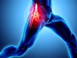 kalça protezi ameliyatı