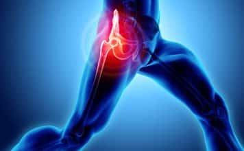 kalça protezi ameliyatı