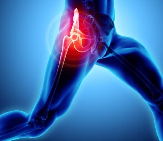 kalça protezi ameliyatı