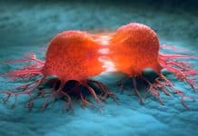 Kanser hakkında doğru sanılan 9 yanlış bilgi! Kanser hakkında