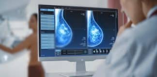 Mamografi