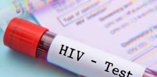 Hiv Testi